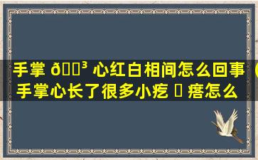 手掌 🌳 心红白相间怎么回事（手掌心长了很多小疙 ☘ 瘩怎么回事）